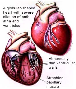 Canine Dilated Cardiomyopathy