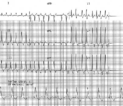 ECG of a 6 year old male Rottweiler