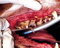Dental Disease