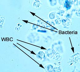 Image result for microscopic examination of urine
